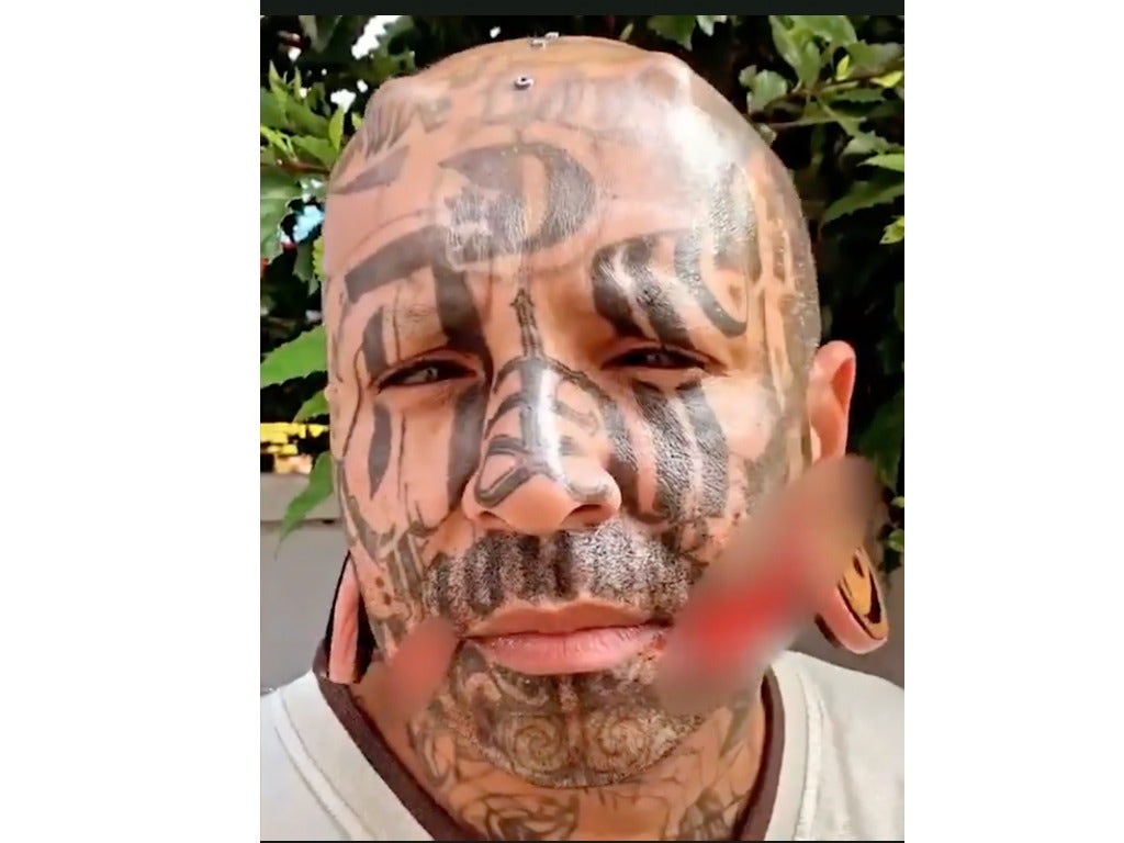 Rapper gets flesh ripped from his face to create a โdemon smileโ