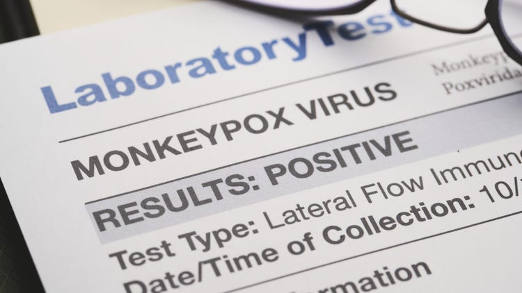 monkeypox
