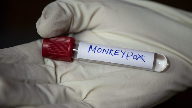 monkeypox
