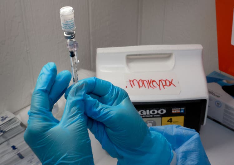 TikToker Duane Cali monkeypox
